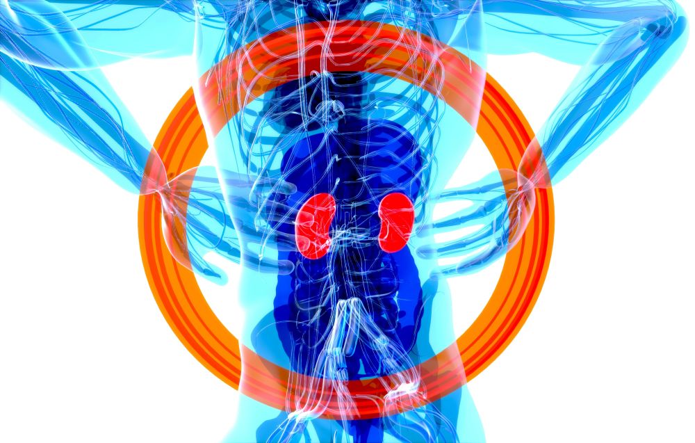 For-Profit Dialysis Chains Linked to Worse Care